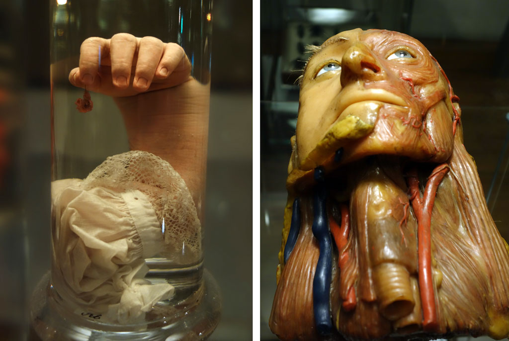 eksponaty anatomiczne
